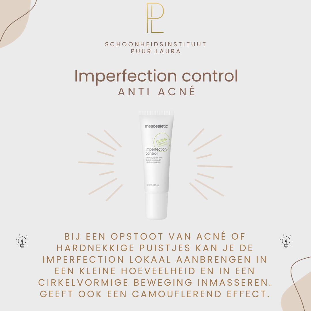 3) Productfiche_Imperfection control
